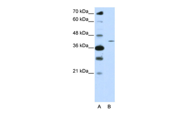 ZNF488 Rabbit Polyclonal Antibody