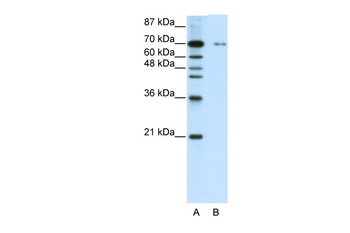 ZNF398 Rabbit Polyclonal Antibody