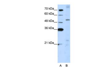 ZNF596 Rabbit Polyclonal Antibody