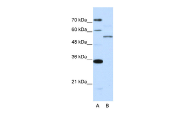 ZNF707 Rabbit Polyclonal Antibody