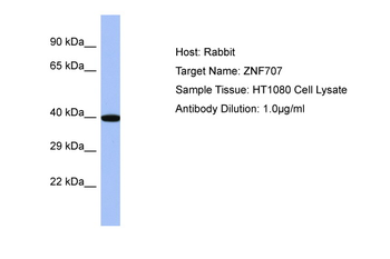 ZNF707 Rabbit Polyclonal Antibody