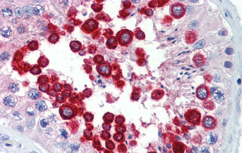 JAZF1 Rabbit Polyclonal Antibody