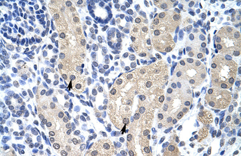 APTX Rabbit Polyclonal Antibody
