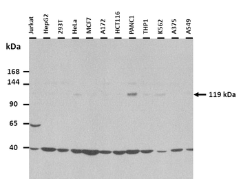 ZNF827 Rabbit Polyclonal Antibody