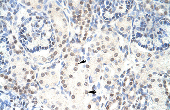 HKR1 Rabbit Polyclonal Antibody
