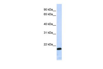ZNF428 Rabbit Polyclonal Antibody