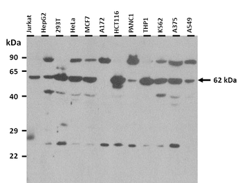 ZNF326 Rabbit Polyclonal Antibody