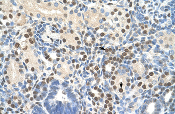 ZNF326 Rabbit Polyclonal Antibody