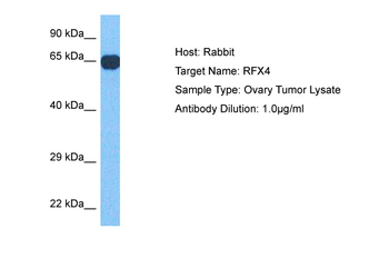 RFX4 Rabbit Polyclonal Antibody