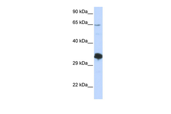 ZNF630 Rabbit Polyclonal Antibody