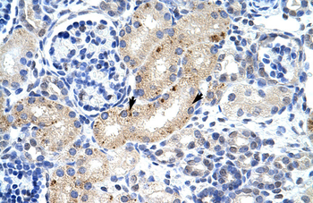 ZFP57 Rabbit Polyclonal Antibody