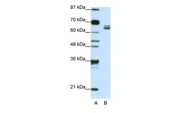 ZFP57 Rabbit Polyclonal Antibody