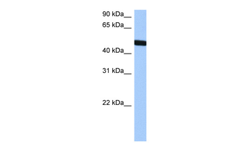 TBX20 Rabbit Polyclonal Antibody