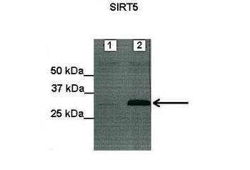SIRT5 Rabbit Polyclonal Antibody