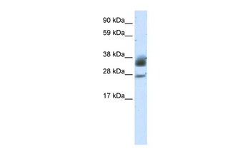 SIRT5 Rabbit Polyclonal Antibody