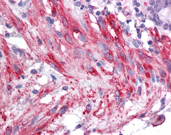 SIRT5 Rabbit Polyclonal Antibody