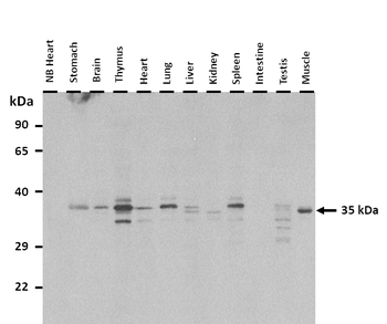 Ehf Rabbit Polyclonal Antibody