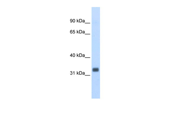 Ehf Rabbit Polyclonal Antibody