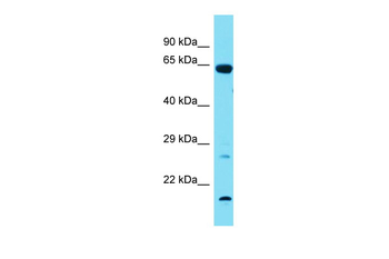 Tbx18 Rabbit Polyclonal Antibody