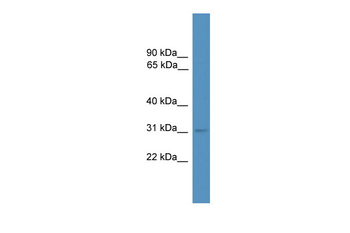 Mbd3 Rabbit Polyclonal Antibody