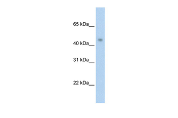 PRMT8 Rabbit Polyclonal Antibody