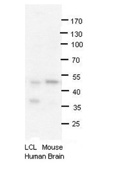 PRMT2 Rabbit Polyclonal Antibody