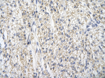 PRMT2 Rabbit Polyclonal Antibody