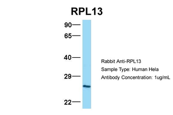 RPL13 Rabbit Polyclonal Antibody