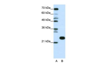 RPL13 Rabbit Polyclonal Antibody