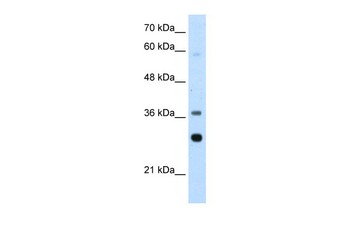 RPLP0 Rabbit Polyclonal Antibody
