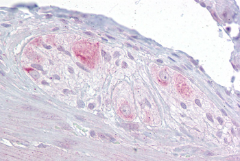 RBMS3 Rabbit Polyclonal Antibody