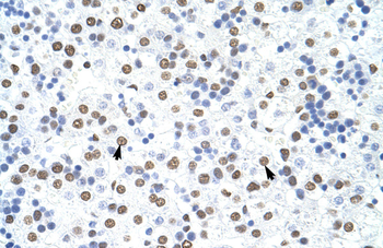 HNRPD Rabbit Polyclonal Antibody