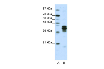 HNRPD Rabbit Polyclonal Antibody