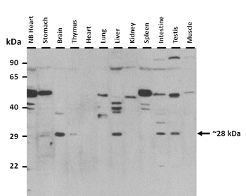 HNRPD Rabbit Polyclonal Antibody