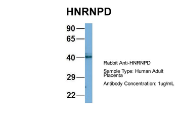 HNRPD Rabbit Polyclonal Antibody