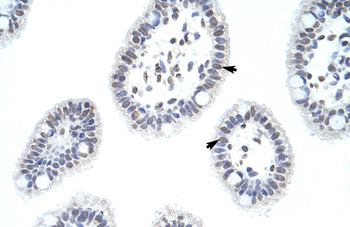 HNRPD Rabbit Polyclonal Antibody
