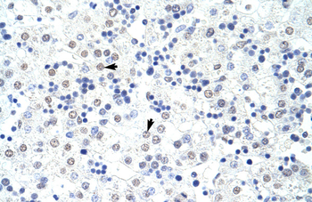 HNRPL Rabbit Polyclonal Antibody
