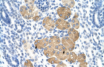 DAZ4 Rabbit Polyclonal Antibody