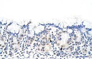 DAZ4 Rabbit Polyclonal Antibody