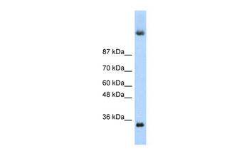 DAZ4 Rabbit Polyclonal Antibody