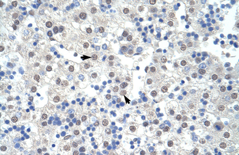 SF3B1 Rabbit Polyclonal Antibody