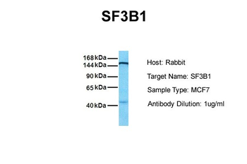 SF3B1 Rabbit Polyclonal Antibody