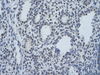 SF3B1 Rabbit Polyclonal Antibody