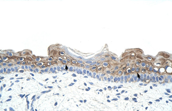 DAZ2 Rabbit Polyclonal Antibody