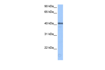 APOBEC3F Rabbit Polyclonal Antibody