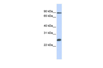 RBPMS Rabbit Polyclonal Antibody