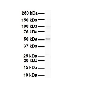 SNRP70 Rabbit Polyclonal Antibody