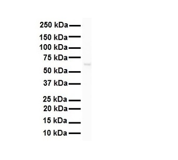 SNRP70 Rabbit Polyclonal Antibody