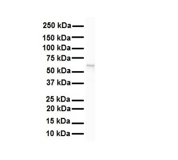 SNRP70 Rabbit Polyclonal Antibody