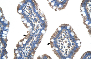 FUS Rabbit Polyclonal Antibody